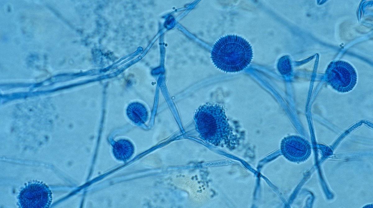 科学家 僵尸蚂蚁已经出现，这种寄生真菌会给人类带来生化危机吗？