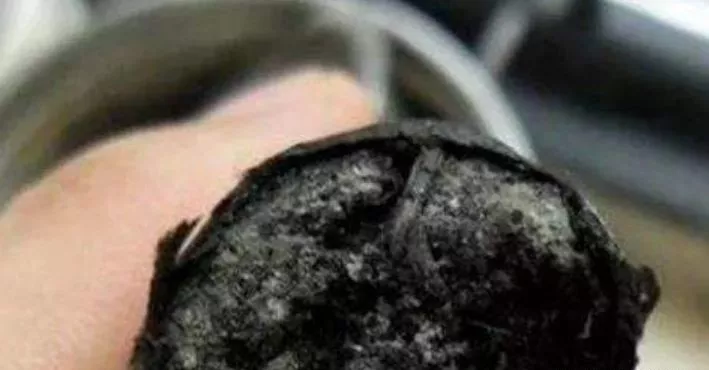 艾灸|艾灸6大禁忌!打死都不要这么干!