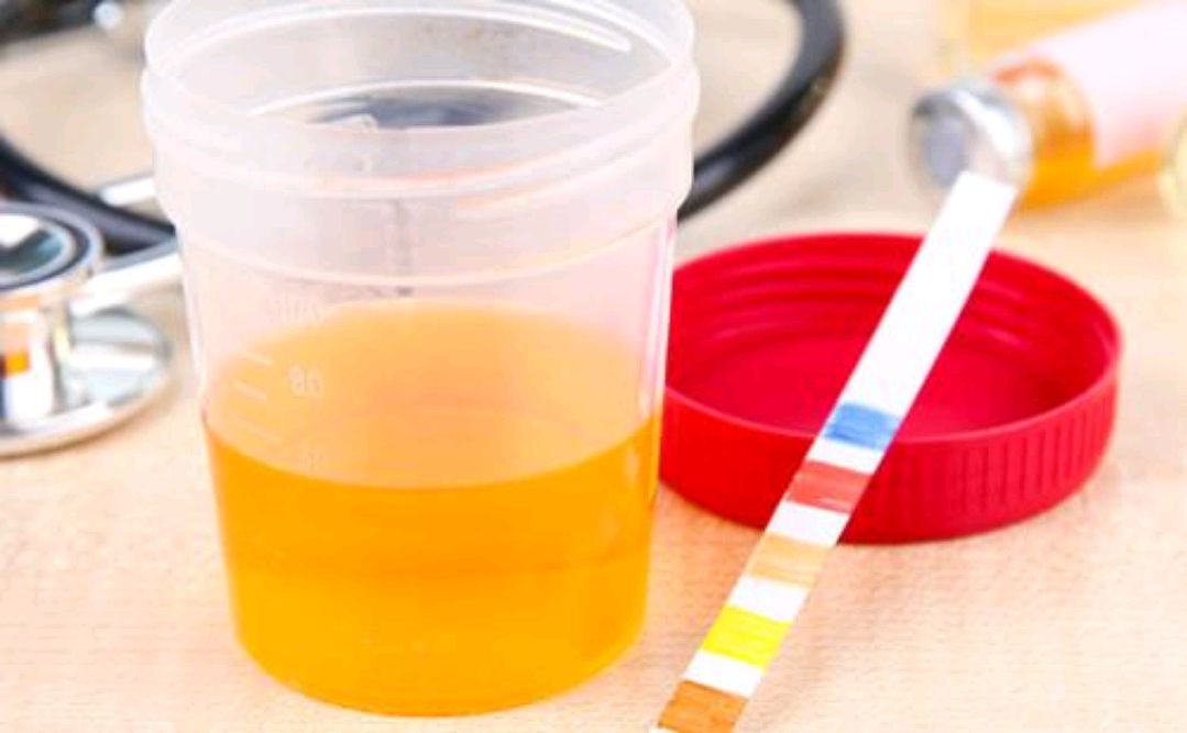 健康无价|尿酸过高容易引发痛风，饮食方面多做3件事，或能帮助降低尿酸值