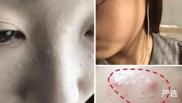 护肤品 43岁李小冉素颜出镜，肌肤状态精致到毛孔，闭口痘痘都没有