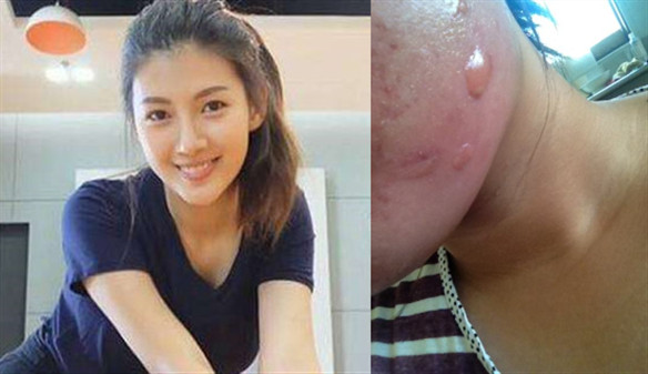 好物官|泰国嫩模为美白“无底线”，连打美白针，现在的样子她老公都害怕