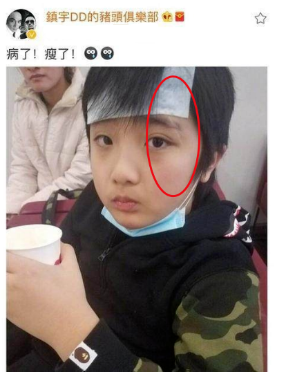 费曼|他曾为了儿子得罪湖南卫视手撕节目组,起因儿子留下了永久性伤疤