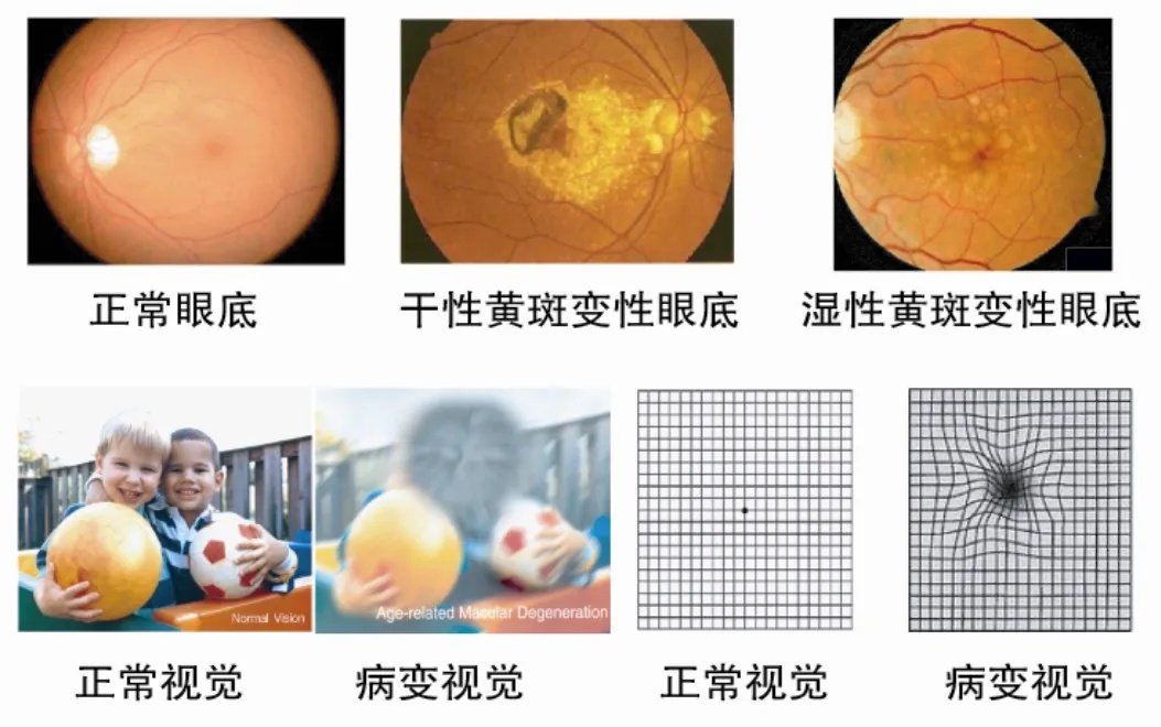 康小灵 这2项体检项目，很多人选择“逃检”，却是不可或缺的检查
