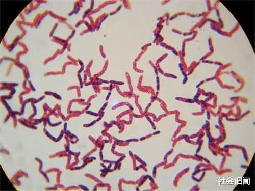 恐龙 科学家为了永生,陪女模特一起注射350万年前细菌,2年后意外发生了