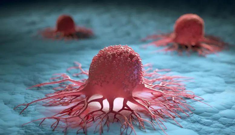 黑色素瘤 Science重磅：科学家找到癌症发生源头，治愈肿瘤有了新思路