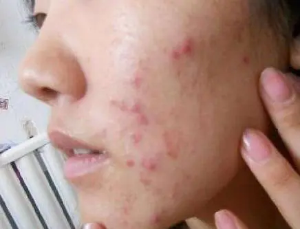 生菜 护肤先抗盐，如果思路错，神仙也难过