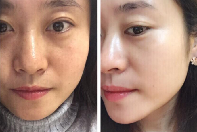 韩雪|大S亲手剪掉肚子上的肉，女学生狂吃维C，女人为了美白有多拼？