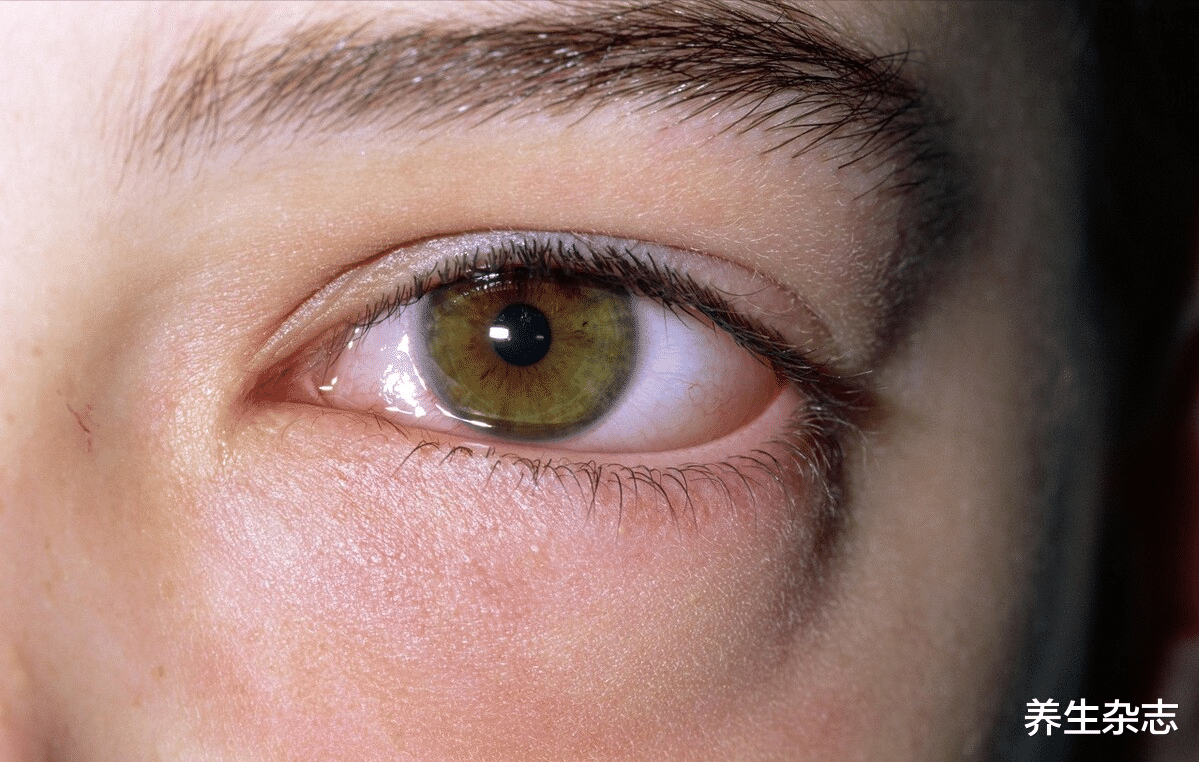 养生杂志|眼干眼涩眼疲劳，蒸汽眼罩有用吗？