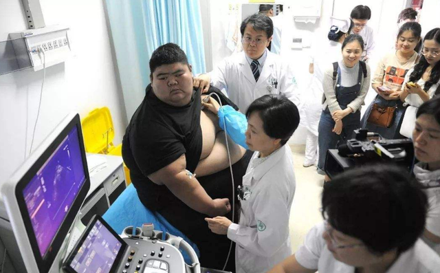饮食|19岁男孩重达668斤,成为“中国第一胖”,减肥一年后,惊艳亮相