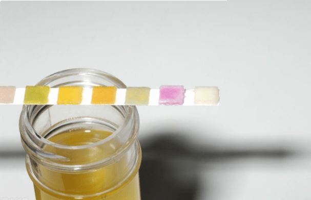 尿毒症|很幸运!4类肾友不会尿毒症,看看有你吗