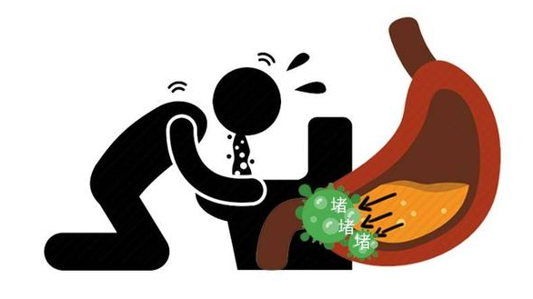 肠胃|肠胃有癌,吃饭先知?饭后出现这3种现象,别以为只是肠道不舒服