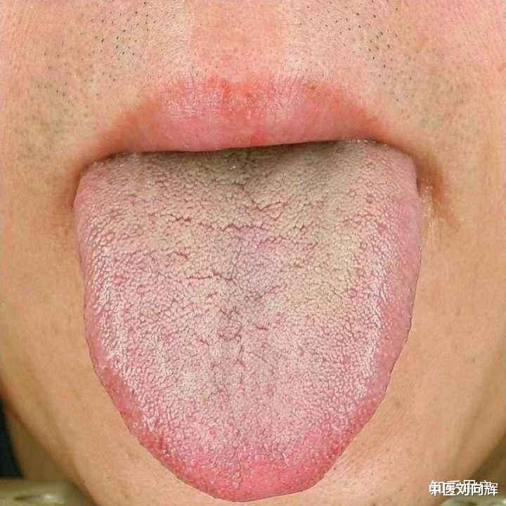 中药|消肿、散结没办法?四味低调、力量大的中药,帮你改善