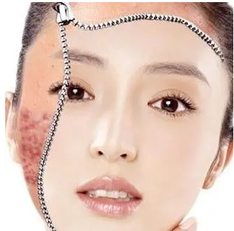 痘痘|祛痘印,收缩毛孔秘诀在这里!