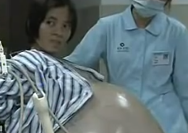 医生 广西女人“怀孕”3年都没生,医生检查后,被吓了一跳