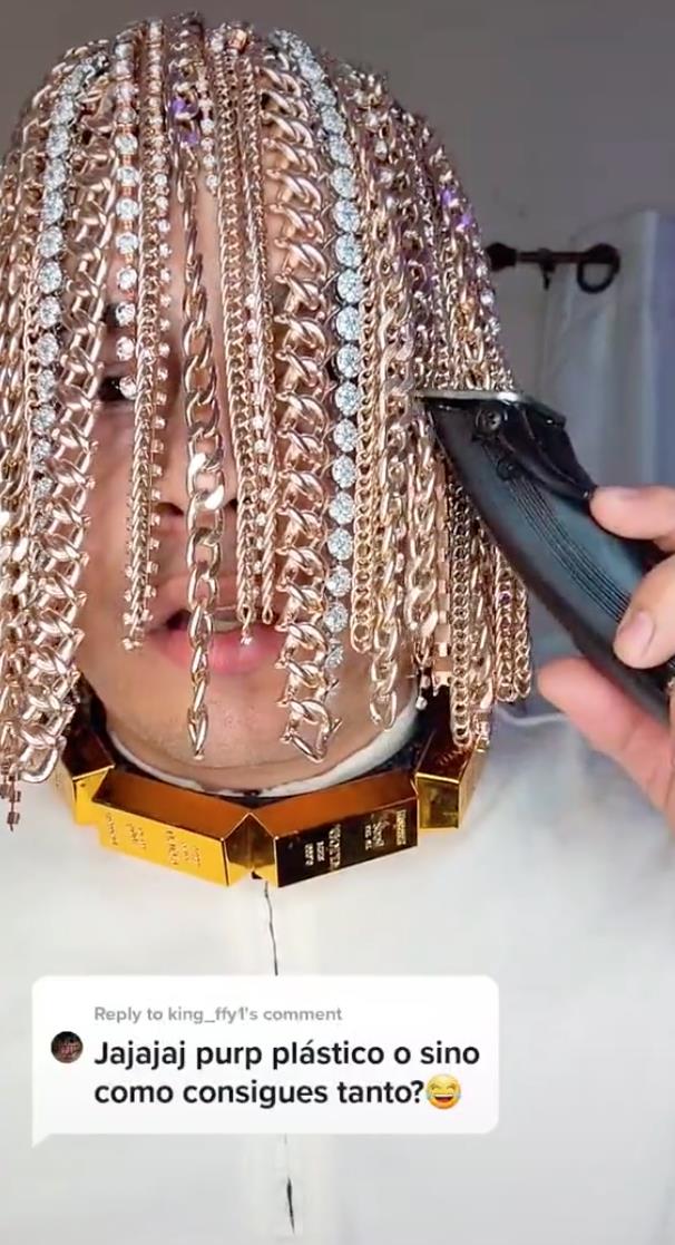 医生|脑门镶钻后，又有歌手钻开头骨植满大金链？网友嘲翻！