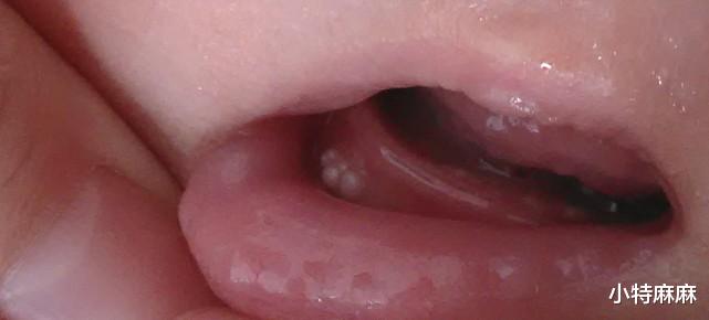 小特麻麻|新手爸妈需要了解的15个新生儿护理小知识