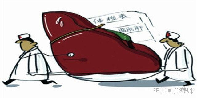 脂肪肝|脂肪肝是“吃”出来的,3种食物是脂肪肝的罪魁祸首,尽量别吃