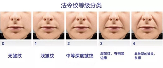 伊美如云|如何“隐藏”法令纹，不要让细节暴露你的年龄