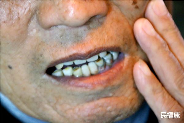 苹果|苹果煮熟了吃，好处也很多，不妨经常吃