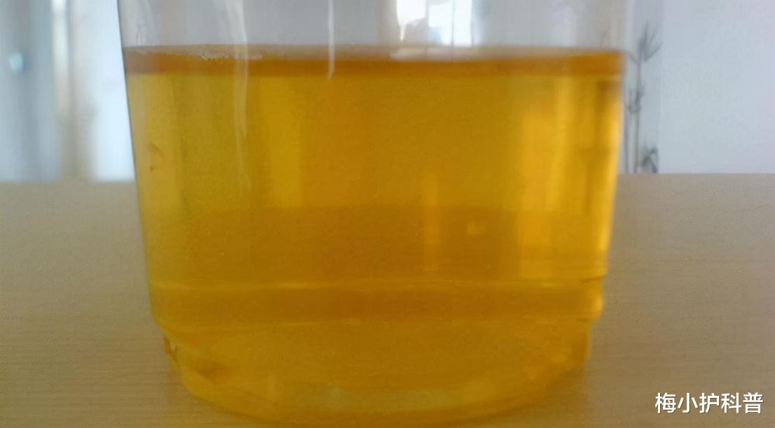 医生|早上一起床,有这5个表现,医生:你很健康!