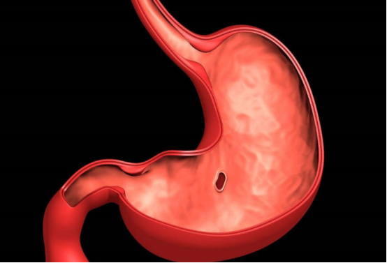 祥光堂|吃一次等于8杯热牛奶，消化科医生：你若爱吃，修复胃?粘膜?，胃会感谢你