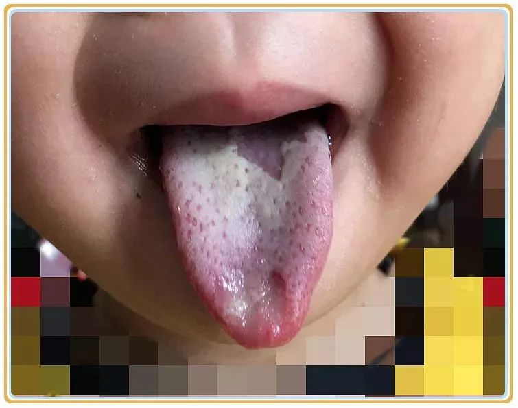 肝脏|孩子眼皮上长包，不痛不痒，一直消不下去？说明这里出了问题！