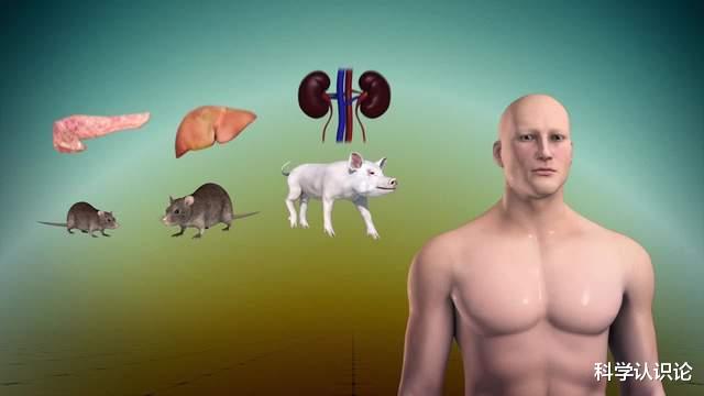 美国科学家:已成功将猪的肾脏移植到人体!没排斥,很快产生尿液