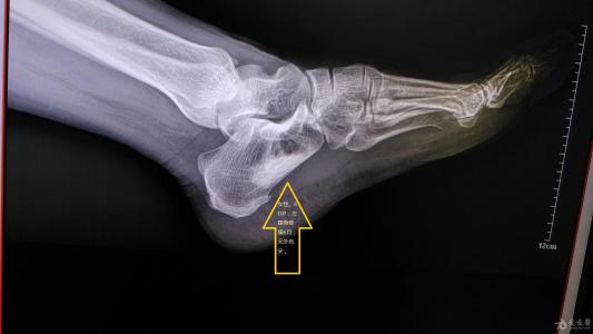 经络|身体这位六大信号，你要小心经络不通了