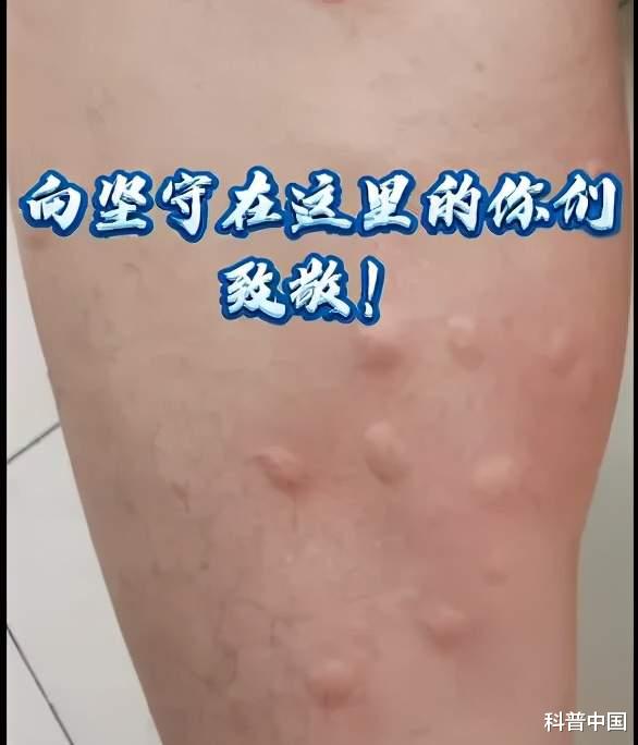 蚊子 一巴掌拍死100多只蚊子！核技术都不能让蚊子\断子绝孙\？