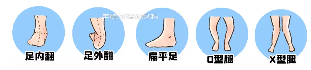 婴幼儿常识|国药育儿知识：这种鞋不安全，宝宝穿了影响发育