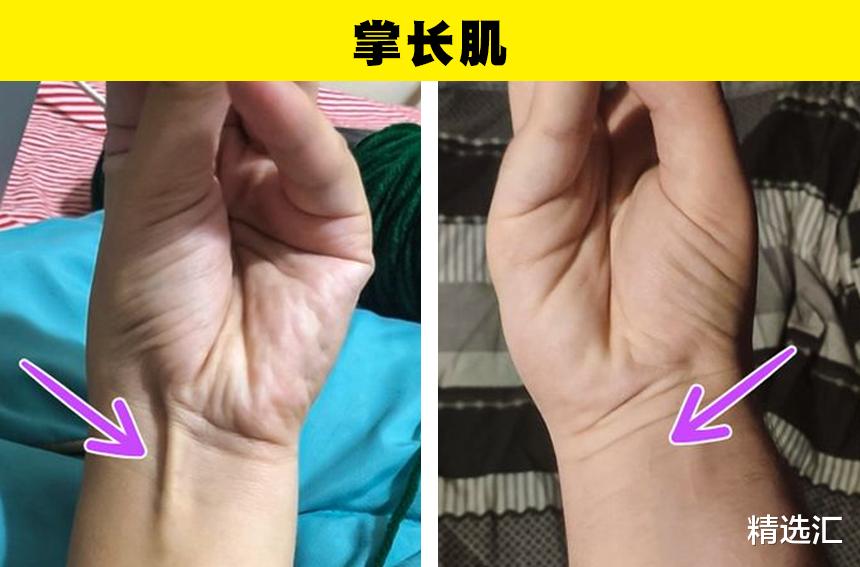 |仅有少数人的身上拥有的7个身体特征