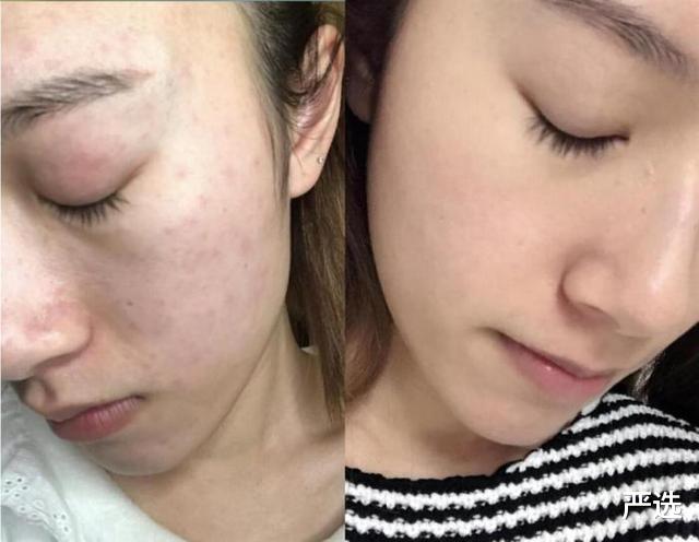 护肤品 国内“尴尬级”的护肤品,曾被误认为地摊货,其实都是胜过兰蔻的牛货