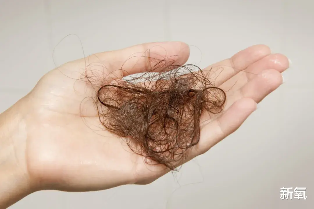 脱发|要是早知道这几招,最起码少掉几万根头发,心痛…