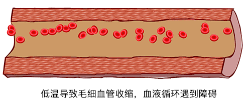 人失温死亡的全过程:从大脑兴奋到反常脱衣,最后带着微笑死去
