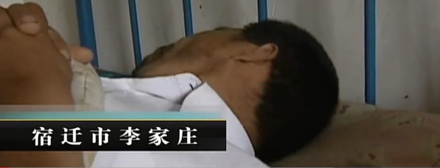 男子咳血不止送到医院,医生检查后难以置信:他体内竟有根木棍