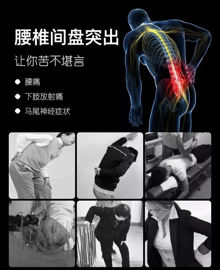 飲食|腰疼是病嗎？聽聽中西醫結合醫院白志強教授怎么說