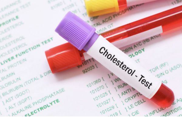 重金属|内科大夫声明:高血脂害怕一种“配方”,敞开吃,血脂乖乖降下来