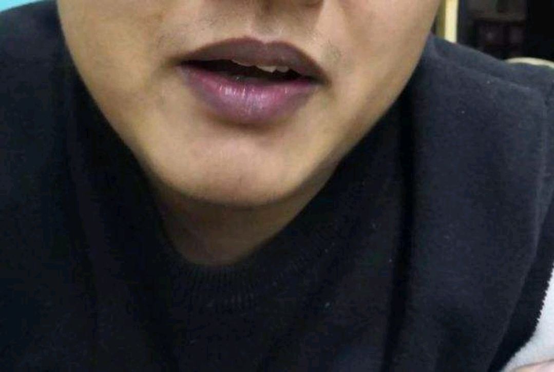 馒头|肺出现了问题，面部有什么提示？若无这4个表现，肺还不错