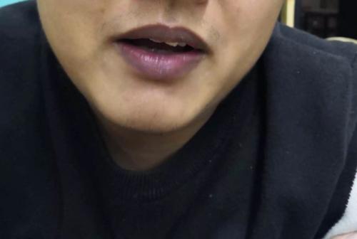 心脏|心脏不好,脸上或有3个“怪相”,希望你能提前了解,尽早预防