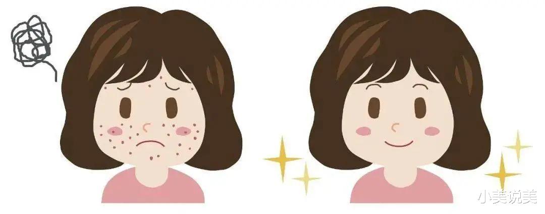 睡眠 淡斑一定能美白吗?你清楚它们的关系吗?