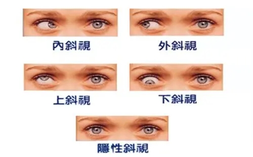 科视E家|【科视眼科】做好这7件事情，抓住孩子视力黄金期