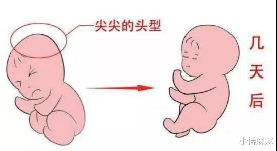 小特麻麻|新手爸妈需要了解的15个新生儿护理小知识