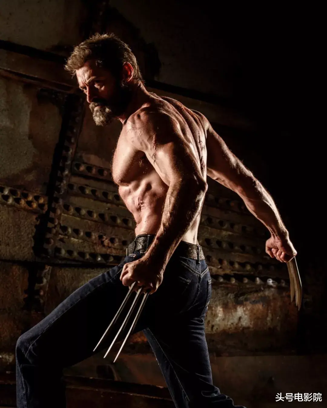 金刚狼|再爆皮肤癌危机！53岁金刚狼接受活检，与大13岁老婆结婚25年无孩