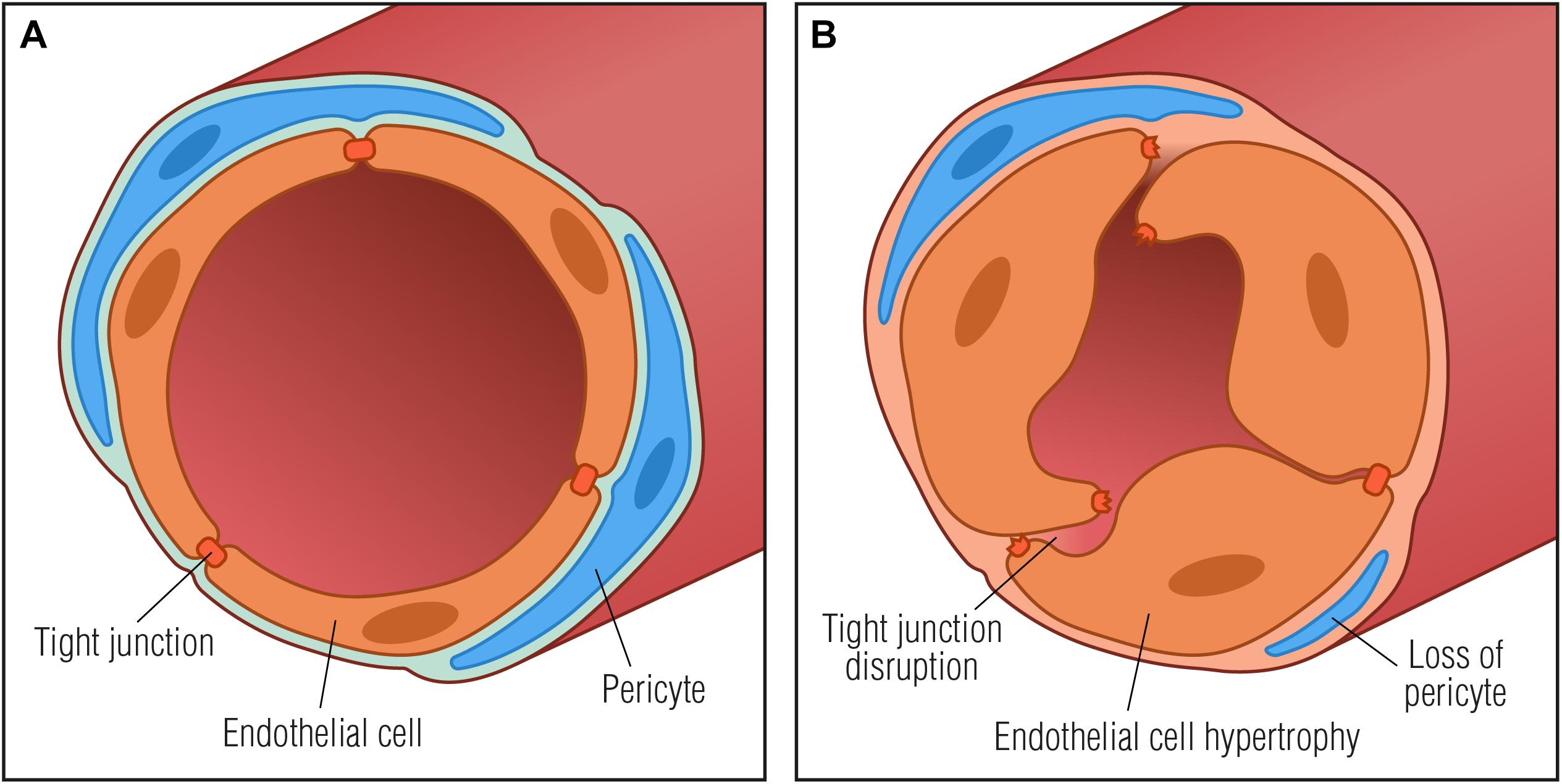 胆固醇|胆固醇分“好坏”?血脂报告重点看什么指标?医生详细为您解答