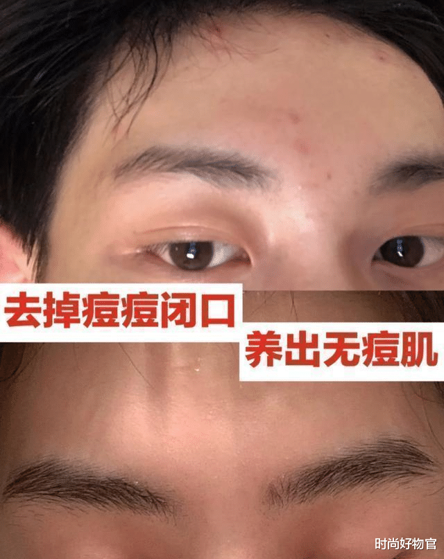 时尚好物官|宋智孝素颜出镜，39岁貌如20岁少女，网友：“换血美容”不是盖的