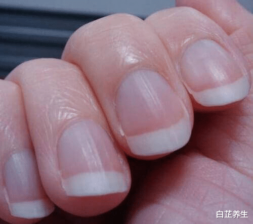 白芷养生|手指上“月牙”越大，说明身体越好？其实很多人都说错了
