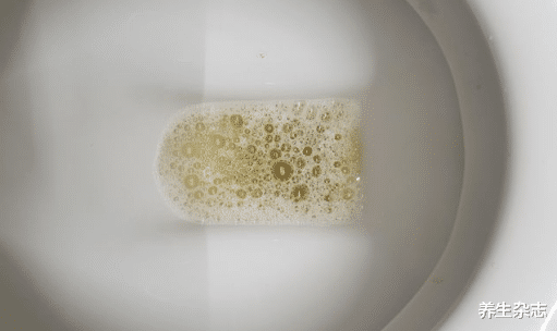 尿酸|“热水变毒水”！卫生组织公布：“1热水壶”或在“侵蚀”你的肾脏