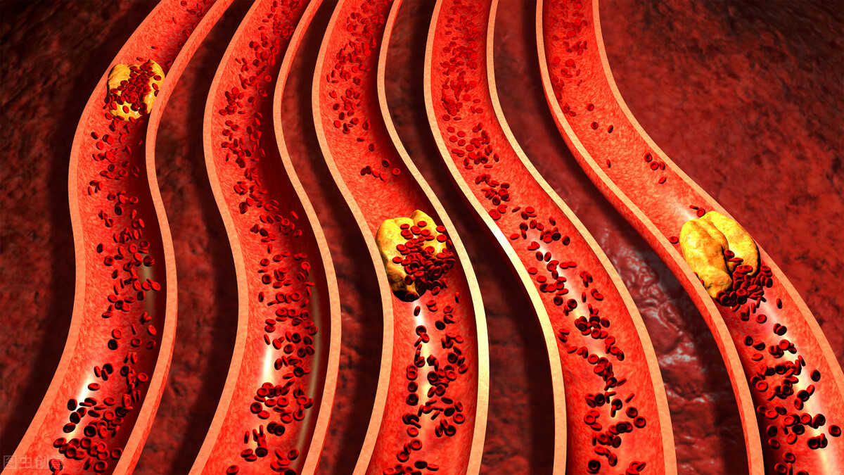 臀部|血管里的清道夫找到了?常吃4种食物,可清除血液“垃圾”,降低血脂