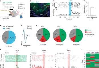空间站 疼痛影响大脑中多巴胺活动（fMOST技术再次助力神经环路研究）
