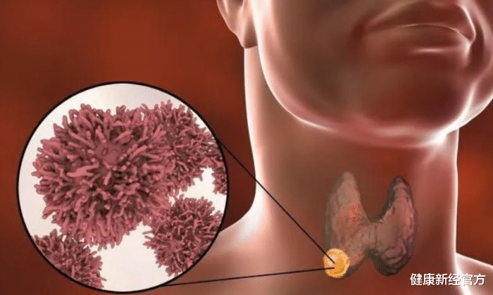 甲状腺|多所医院联合声明：“1塑料袋”，别再放冰箱，会加速甲状腺病变，趁早扔